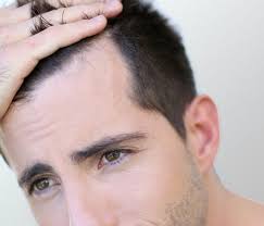 chutte de cheveux